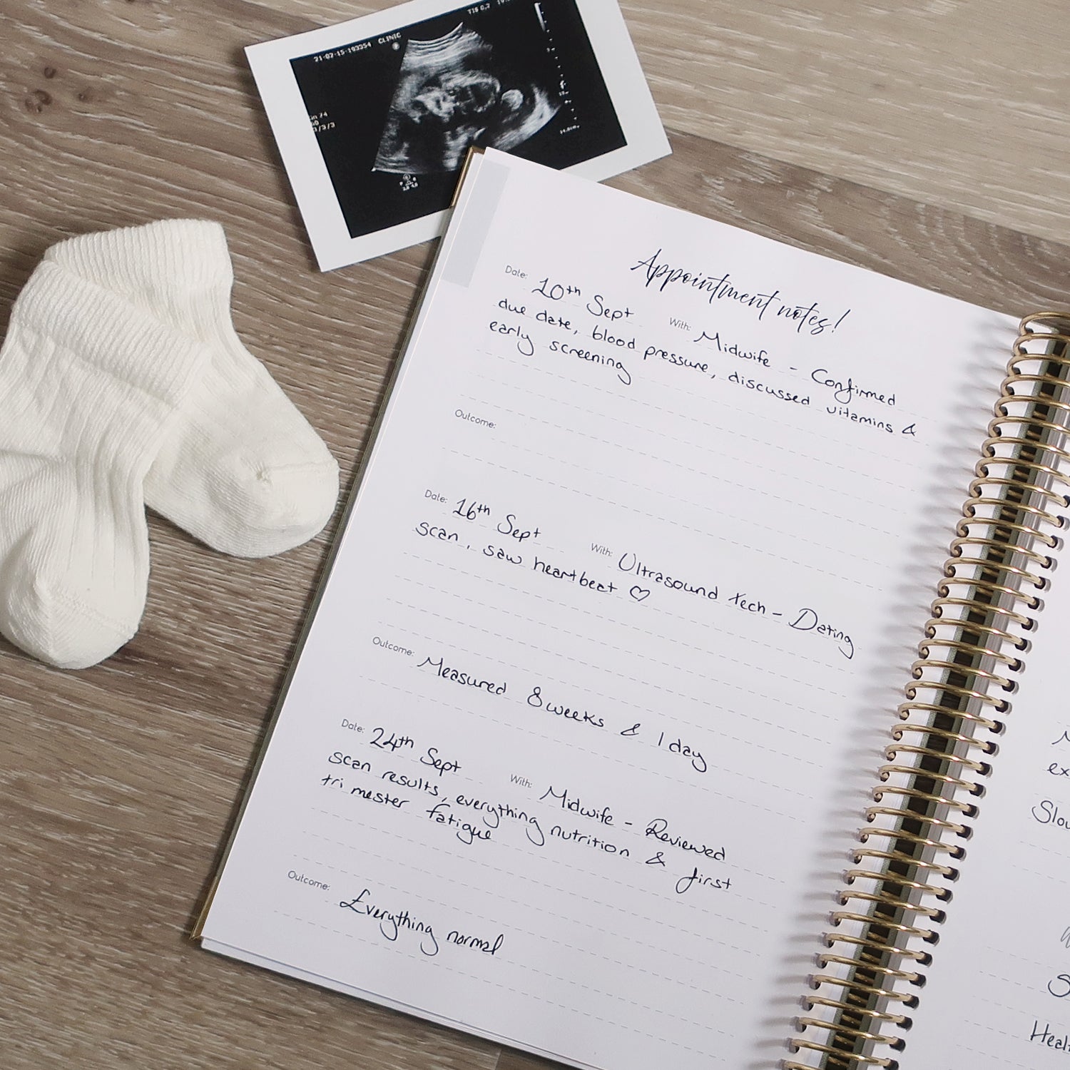 Pregnancy Journal Open On Appointment Notes Page with ultrasound scan and socks on a wooden desk